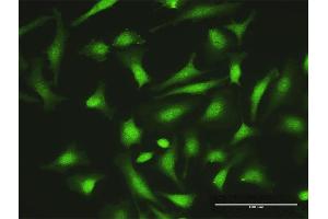 Immunofluorescence of purified MaxPab antibody to ZNF511 on HeLa cell. (ZNF511 Antikörper  (AA 1-252))