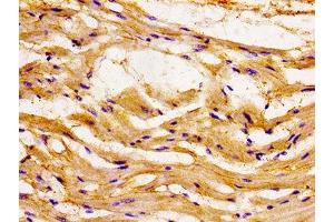 Immunohistochemistry of paraffin-embedded human heart tissue using ABIN7145958 at dilution of 1:100 (CCL15 Antikörper  (AA 22-113))