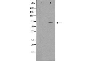 Western blot analysis of extracts from Rat Heart cells using SLC22A5 antibody. (SLC22A5 Antikörper  (C-Term))