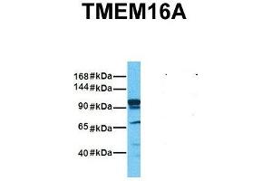 Host:  Rabbit  Target Name:  TMEM16A  Sample Tissue:  Human Fetal Liver  Antibody Dilution:  1. (ANO1 Antikörper  (Middle Region))