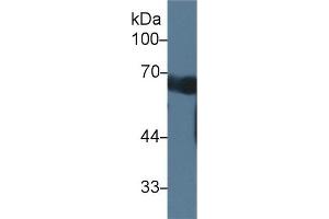 Detection of CCDC60 in Mouse Serum using Polyclonal Antibody to Coiled Coil Domain Containing Protein 60 (CCDC60) (CCDC60 Antikörper  (AA 1-186))