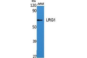 Western Blot (WB) analysis of specific cells using LRG1 Polyclonal Antibody. (LRG1 Antikörper  (C-Term))