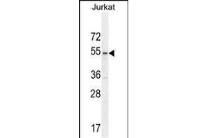 P1 Antibody (Center) (ABIN654665 and ABIN2844361) western blot analysis in Jurkat cell line lysates (35 μg/lane). (MPP1 Antikörper  (AA 301-327))