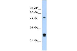 IGSF1 antibody used at 1. (IGSF1 Antikörper  (N-Term))