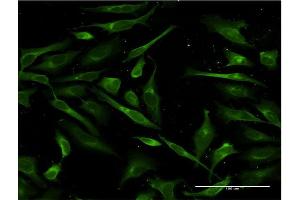 Immunofluorescence of monoclonal antibody to SFTPA1 on HeLa cell. (Surfactant Protein A1 Antikörper  (AA 83-199))