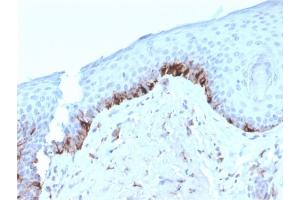 Formalin-fixed, paraffin-embedded human Skin stained with TYRP1-Monospecific Mouse Monoclonal Antibody (TYRP1/3282). (Tyrosinase-Related Protein 1 Antikörper  (AA 257-377))