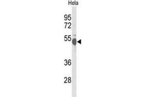 Western blot analysis of CREB3L2 Antibody (C-term) in Hela cell line lysates (35µg/lane). (CREB3L2 Antikörper  (C-Term))