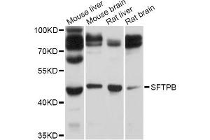 Western blot analysis of extracts of various cell lines, using SFTPB Antibody (ABIN5995955) at 1/1000 dilution. (SFTPB Antikörper)