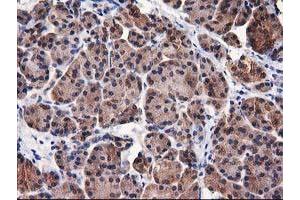 Image no. 5 for anti-Destrin (Actin Depolymerizing Factor) (DSTN) antibody (ABIN1497910) (Destrin Antikörper)