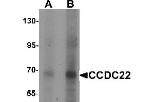 Western blot analysis of CCDC22 in 293 cell lysate with CCDC22 antibody at (A) 1 and (B) 2 µg/mL. (CCDC22 Antikörper  (N-Term))