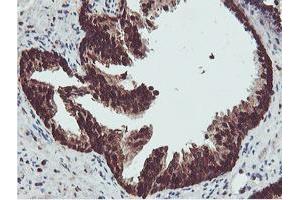 Image no. 3 for anti-Proteasome (Prosome, Macropain) Subunit, beta Type, 7 (PSMB7) (AA 58-277) antibody (ABIN1491598)