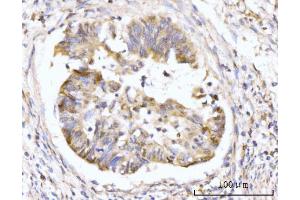 IHC analysis of HMGCS1 using anti-HMGCS1 antibody (ABIN7600928).
