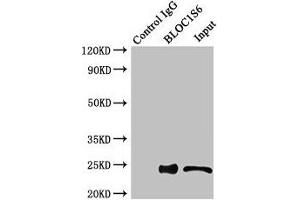 Immunoprecipitating BLOC1S6 in HEK293 whole cell lysate Lane 1: Rabbit control IgG instead of (1 μg) instead of ABIN7145610 in HEK293 whole cell lysate. (Pallidin Antikörper  (AA 1-170))