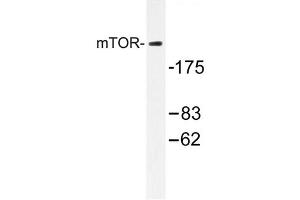Image no. 1 for anti-Mechanistic Target of Rapamycin (serine/threonine Kinase) (mTOR) antibody (ABIN272127) (MTOR Antikörper)