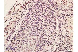 Formalin-fixed and paraffin embedded mouse embryo labeled with Rabbit Anti-Lin28 Polyclonal Antibody, Unconjugated (ABIN1386838) at 1:200 followed by conjugation to the secondary antibody and DAB staining (Lin28A/ B (AA 75-180) Antikörper)