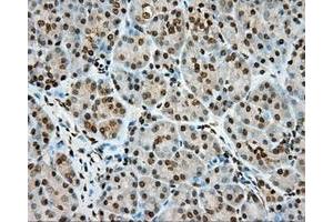 Immunohistochemical staining of paraffin-embedded Human colon tissue using anti-MTRF1L mouse monoclonal antibody. (MTRF1L Antikörper)