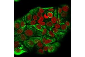 Immunofluorescence (IF) image for anti-Keratin 15 (KRT15) antibody (ABIN6939913)
