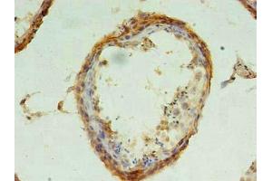 Immunohistochemistry of paraffin-embedded human testis tissue using ABIN7147533 at dilution of 1:100 (CHMP6 Antikörper  (AA 2-201))