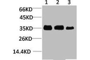 Western blot analysis of 1) Human Brain Tissue, 2) Mouse Brain Tissue, 3) Rat Brain Tissue using L-type Ca++ CP γ4 Polyclonal Antibody. (CACNG4 Antikörper)