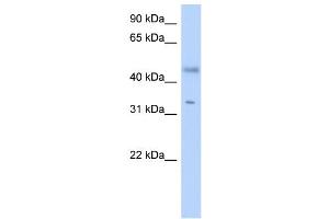 WB Suggested Anti-RDHE2 Antibody Titration: 0. (SDR16C5 Antikörper  (Middle Region))