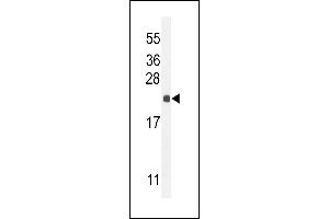 hCG_2024410 Antibody (C-term) (ABIN654993 and ABIN2850479) western blot analysis in mouse liver tissue lysates (35 μg/lane). (hCG_2024410 (AA 187-215), (C-Term) Antikörper)