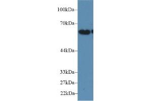 Western Blotting (WB) image for anti-Fucosyltransferase 4 (Alpha (1,3) Fucosyltransferase, Myeloid-Specific) (FUT4) (AA 144-389) antibody (ABIN7440164)