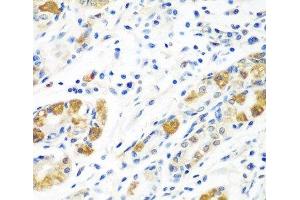 Immunohistochemistry of paraffin-embedded Human stomach using BLVRB Polyclonal Antibody at dilution of 1:100 (40x lens). (BLVRB Antikörper)