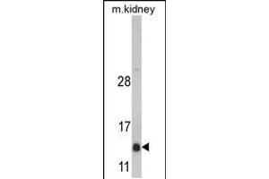 Western blot analysis of DNAJC19 Antibody in mouse kidney tissue lysates (35ug/lane)