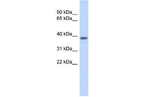 WB Suggested Anti-WDR21B Antibody Titration: 0. (DCAF4L1 Antikörper  (Middle Region))