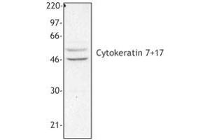 Image no. 1 for anti-Keratin 7/17 (KRT7/17) antibody (ABIN293955) (Keratin 7/17 Antikörper)