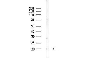 anti-Ribosomal Protein L15 (RPL15) (C-Term) antibody