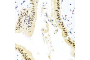 Immunohistochemistry of paraffin-embedded human liver injury using ZBTB17 antibody (ABIN5974597) at dilution of 1/100 (40x lens). (ZBTB17 Antikörper)