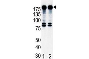 Western blot analysis of ErbB2 in T47D cell lysate, either noninduced (Lane 1) or induced with HRG (2).