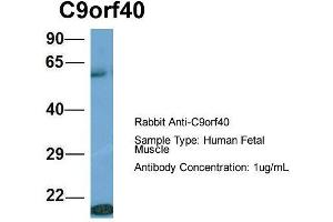 Host: Rabbit  Target Name: C9orf40  Sample Tissue: Human Fetal Muscle  Antibody Dilution: 1. (C9orf40 Antikörper  (Middle Region))