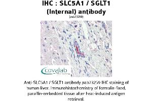 Image no. 2 for anti-Solute Carrier Family 5 (Sodium/glucose Cotransporter), Member 1 (SLC5A1) (Internal Region) antibody (ABIN1739389)