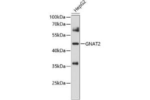 Western blot analysis of extracts of HepG2 cells, using GN antibody (ABIN6132936, ABIN6141215, ABIN6141216 and ABIN6214578) at 1:1000 dilution. (GNAT2 Antikörper  (AA 1-220))