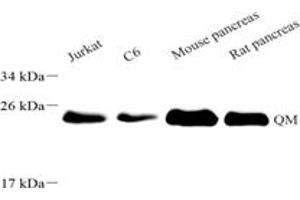 Western Blotting (WB) image for anti-Ribosomal Protein L10 (RPL10) antibody (ABIN7075428)