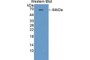 Western blot analysis of the recombinant protein. (PADI2 Antikörper  (Met1, Thr300))