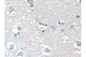 Detection of PLCB1 in Human Cerebrum Tissue using Polyclonal Antibody to Phospholipase C Beta 1 (PLCB1) (Phospholipase C beta 1 Antikörper  (AA 316-476))