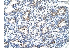 CEACAM6 antibody was used for immunohistochemistry at a concentration of 4-8 ug/ml to stain Alveolar cells (arrows) in Human Lung. (CEACAM6 Antikörper)