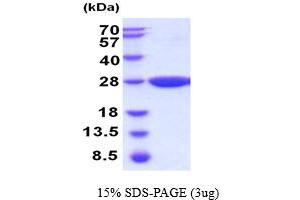 Glutathione S-Transferase, pi 2 (GSTP2) (AA 1-210) protein (His tag)