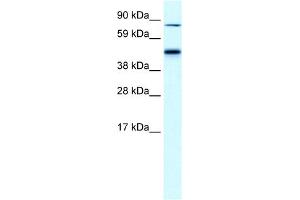 WB Suggested Anti-EPB42 Antibody Titration:  0. (EPB42 Antikörper  (Middle Region))
