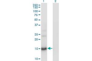 Western Blot analysis of BTG2 expression in transfected 293T cell line by BTG2 monoclonal antibody (M01), clone 1A5. (BTG2 Antikörper  (AA 59-158))