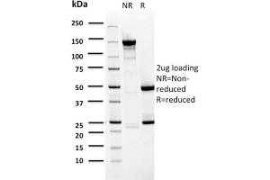 SDS-PAGE Analysis Purified BARX1 Mouse Monoclonal Antibody (BARX1/2759).