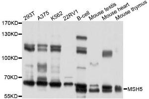 Western blot analysis of extracts of various cells, using MSH5 antibody. (MSH5 Antikörper)