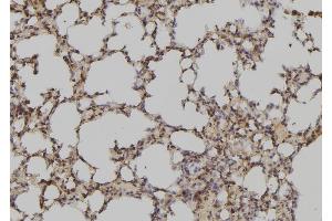 ABIN6279149 at 1/100 staining Mouse lung tissue by IHC-P. (ATXN7L3 Antikörper  (Internal Region))
