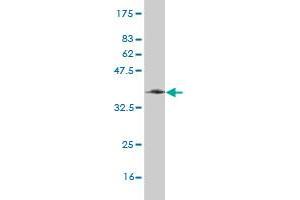 Western Blot detection against Immunogen (36. (RAB31 Antikörper  (AA 96-195))