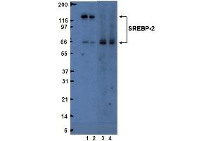 Western blot analysis of SREBP-2. (SREBF2 Antikörper  (AA 833-1141))