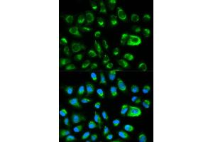Immunofluorescence analysis of HeLa cells using GAS2 antibody (ABIN5970514). (GAS2 Antikörper)