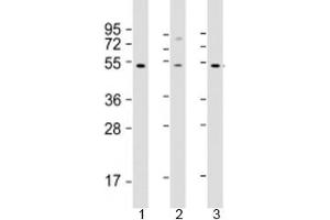 Western blot testing of human 1) HT-1080, 2) SH-SY5Y and 3) Y79 cell lysate with ZNF513 antibody at 1:2000. (ZNF513 Antikörper  (AA 82-115))